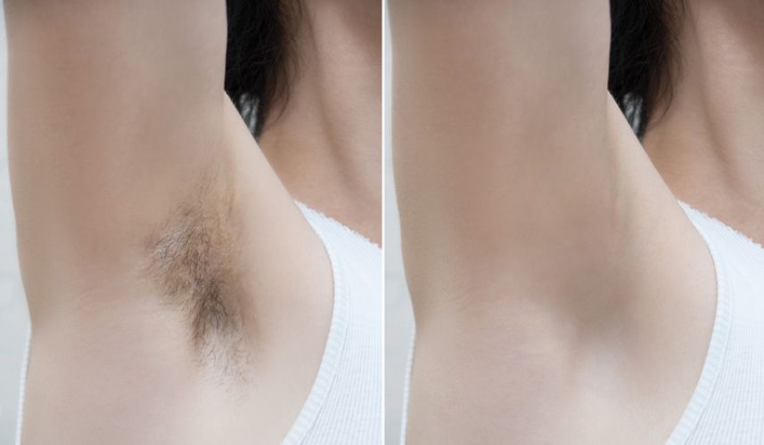 Hair Removal Device offers Pain Free - nova boutique