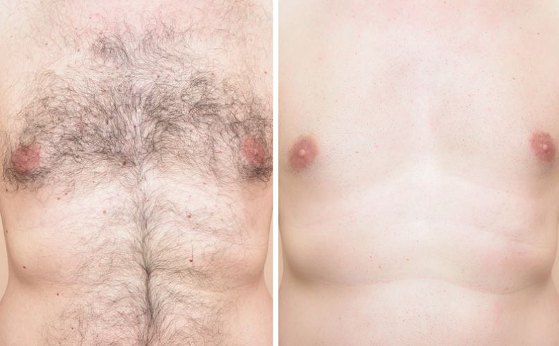 Hair Removal Device offers Pain Free - nova boutique
