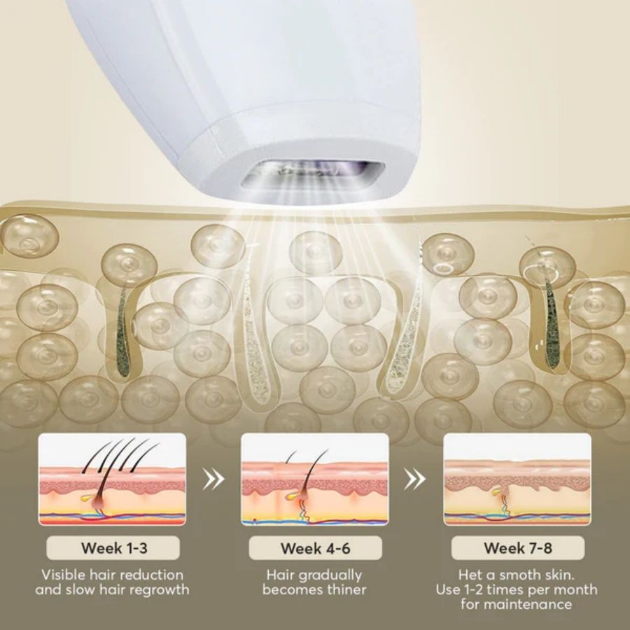 Laser Hair Removal - nova boutique