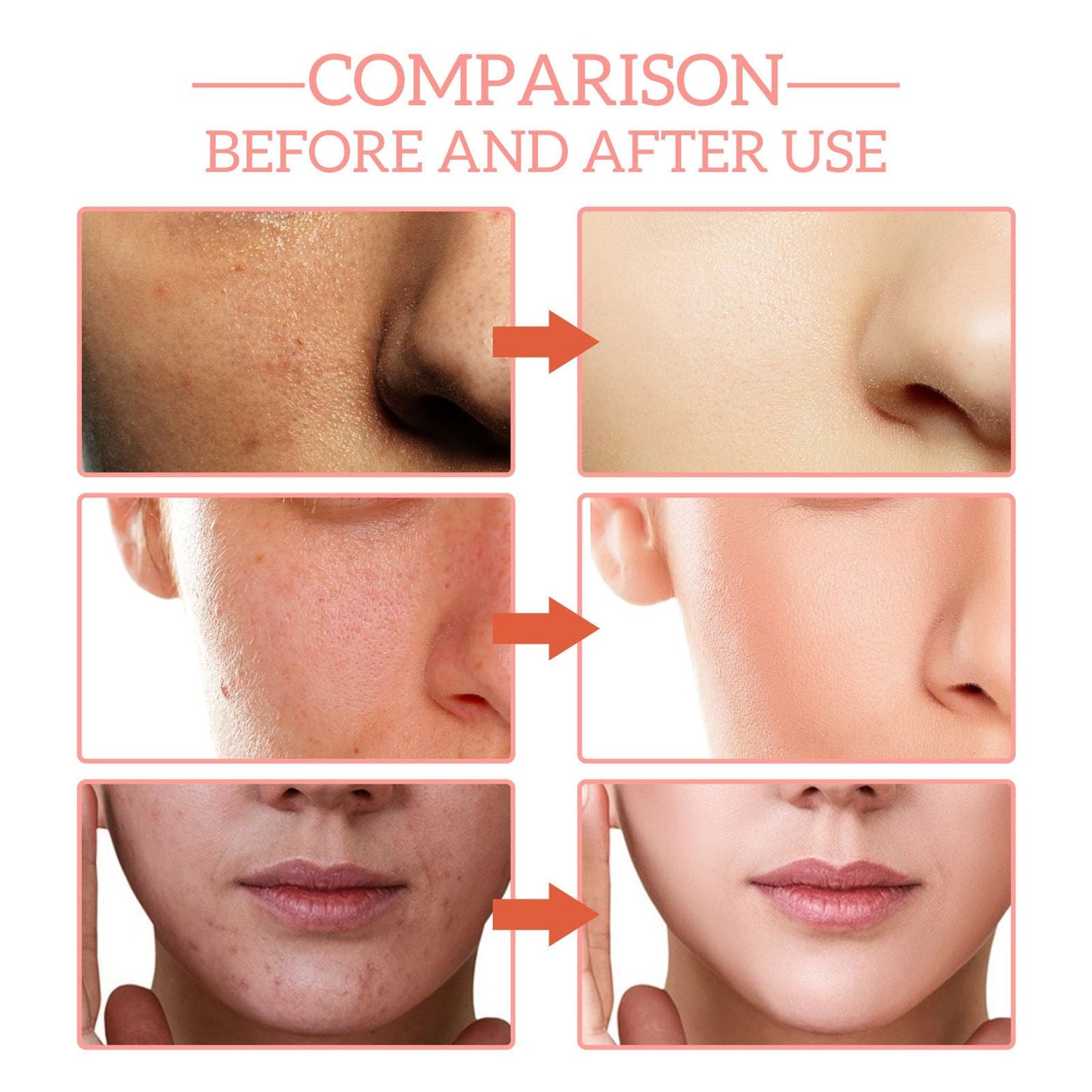 5 In 1 Facial Serum,30 Vitamin C - nova boutique