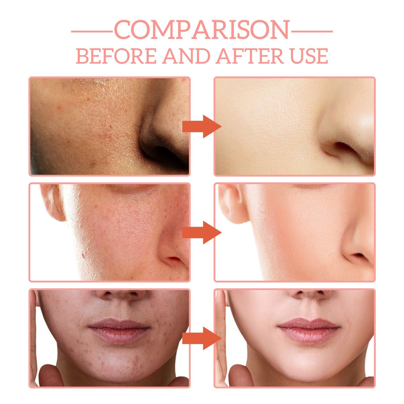 5 In 1 Facial Serum,30 Vitamin C - nova boutique