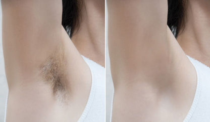 Hair Removal Device offers Pain Free - nova boutique