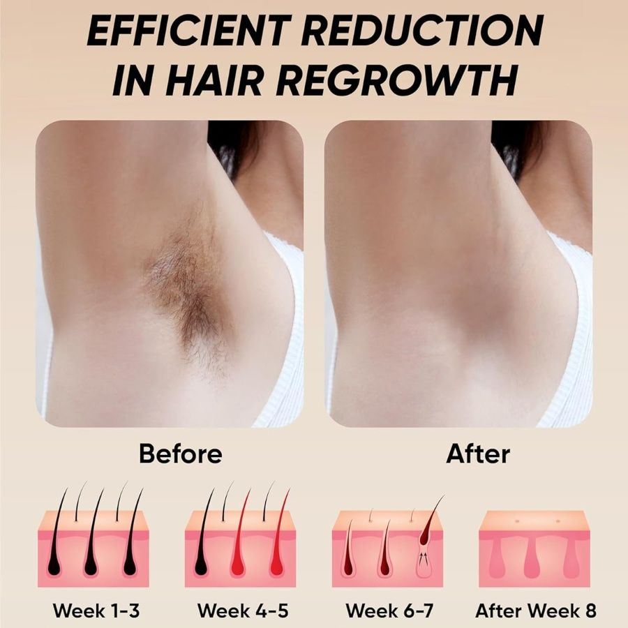 Laser Hair Removal - nova boutique