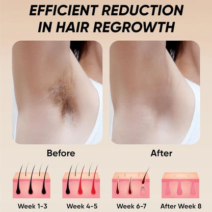 Laser Hair Removal - nova boutique